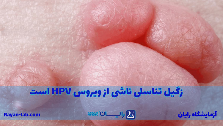 عکس زگیل تناسلی