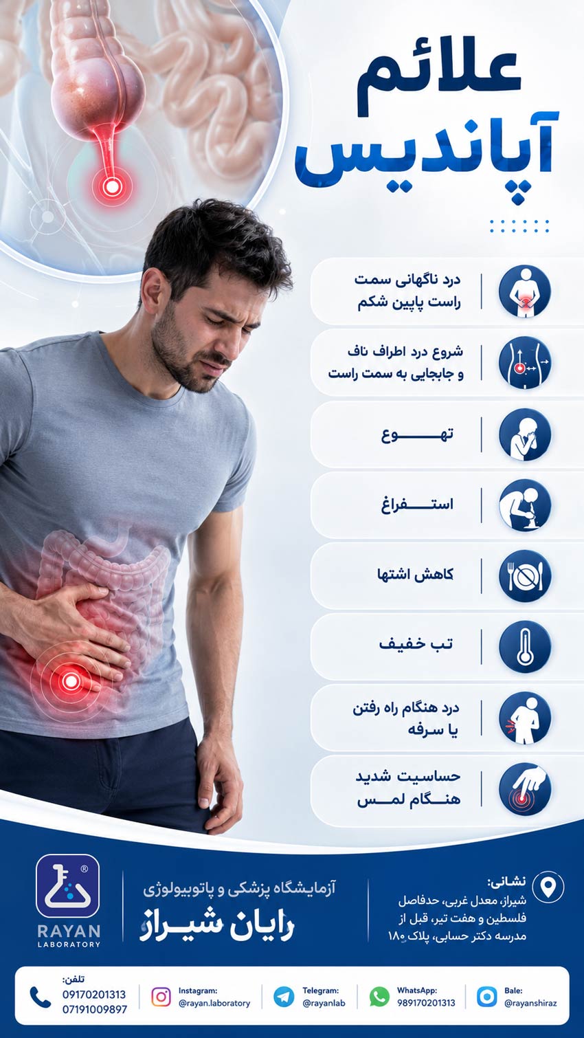 علائم-آپاندیس-چیست