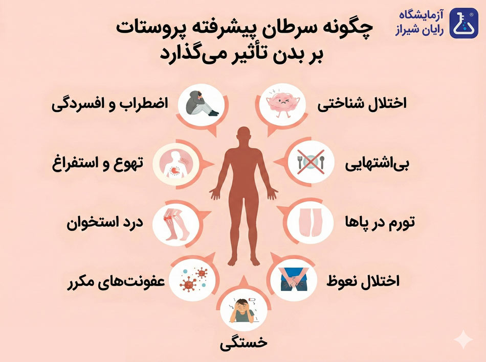 علائم پروستات در مردان چیست