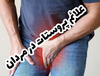 علائم پروستات در مردان | تکرر، سوزش و ضعف جریان ادرار (2026)