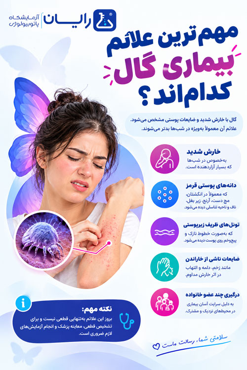 علائم گال چیست