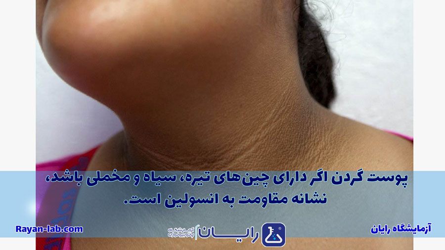 علائم خطرناک کبد چرب