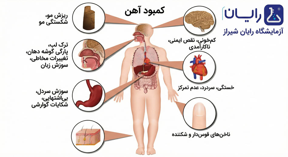 علائم کمبود آهن چیست