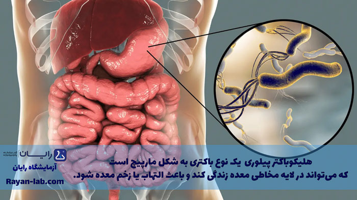 علائم میکروب معده چیست-1