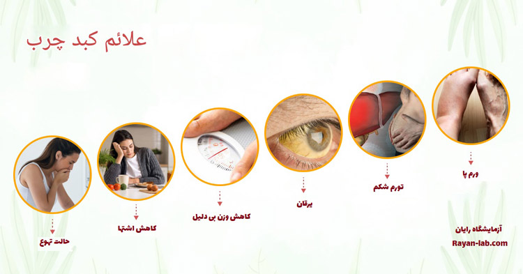 علائم سرطان کبد چیست