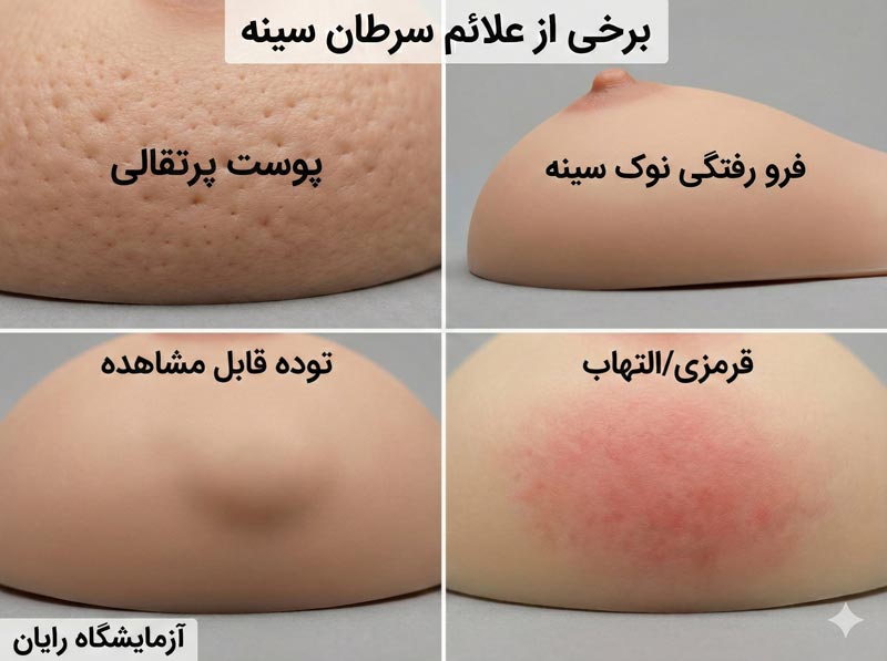 علائم سرطان سینه چیست