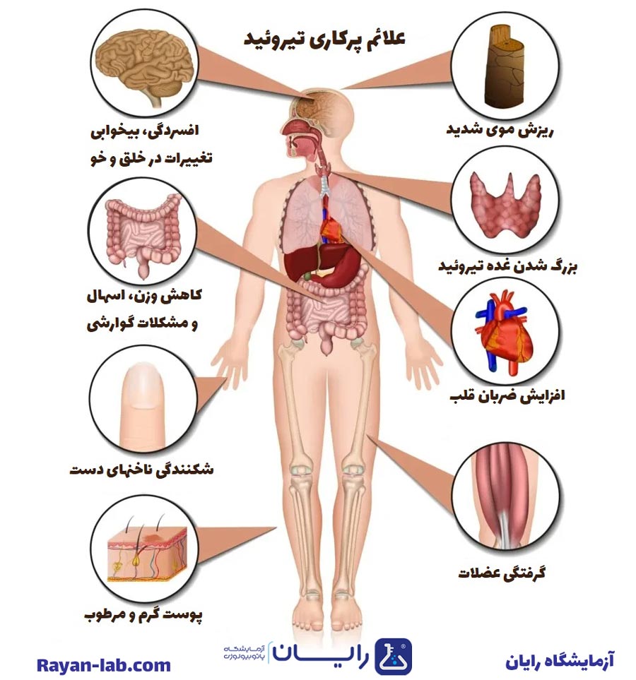 علائم تیروئید پرکار