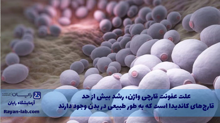 علت عفونت قارچی واژن