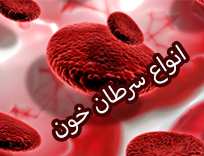 سرطان خون چیست? چه کسانی در معرض ابتلا به آن هستند؟ (1405)