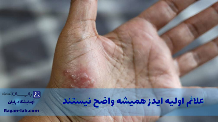 آزمایش ایدز در شیراز