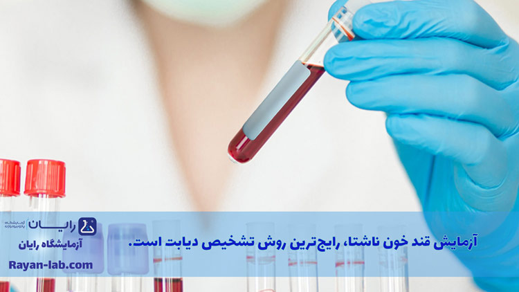 آزمایش دیابت در شیراز