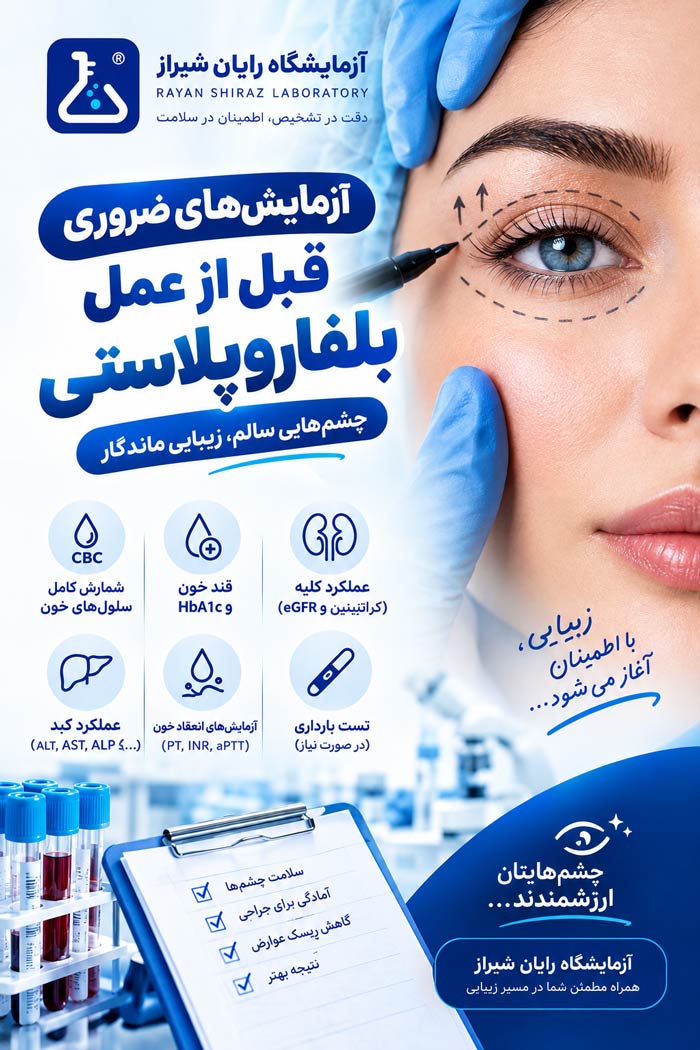 آزمایش قبل از عمل بلفاروپلاستی