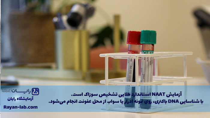 آزمایش سوزاک در شیراز