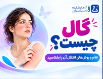 گال چیست؟ علائم، راه‌های انتقال، تشخیص و درمان گال