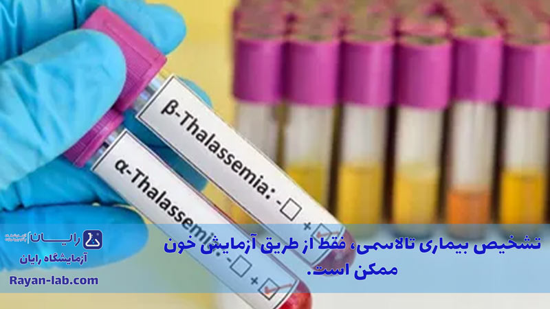 آزمایش تالاسمی چیست
