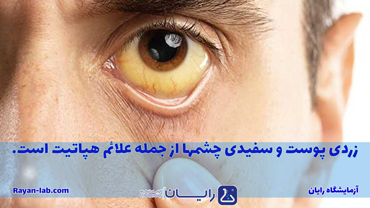 التهاب کبد چیست