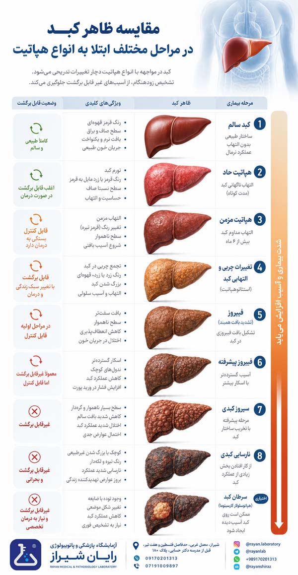 سرطان کبد چیست؟