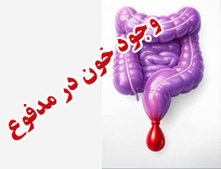 ‫چه مقدار خون در مدفوع خطرناک است؟ علائم خطرناک را بشناسید
