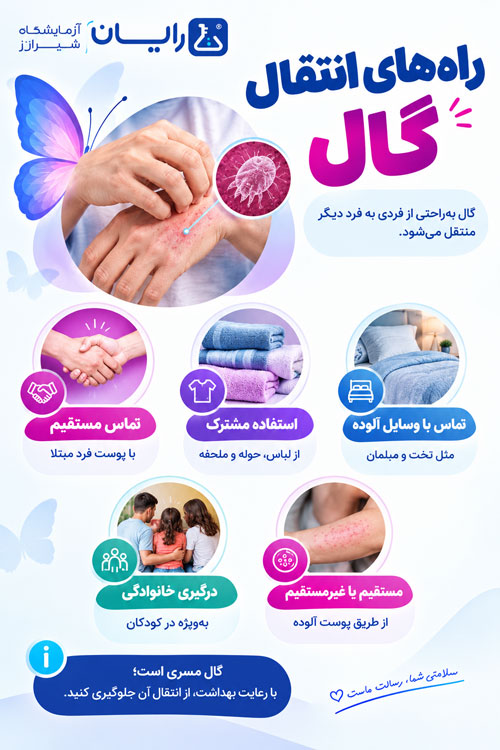راه های انتقال گال