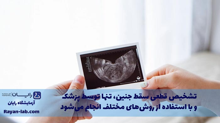 سقط جنین چیست