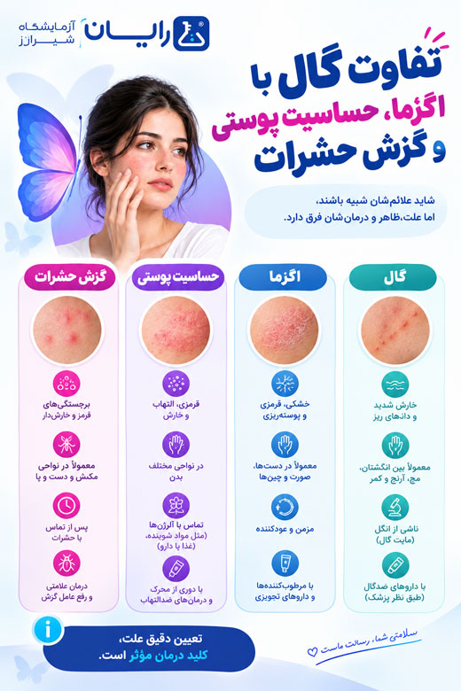 تفاوت گال با خارشهای پوستی