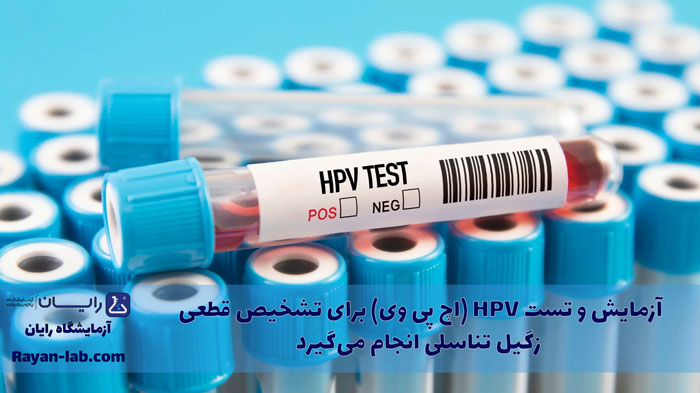 تست زگیل تناسلی در شیراز