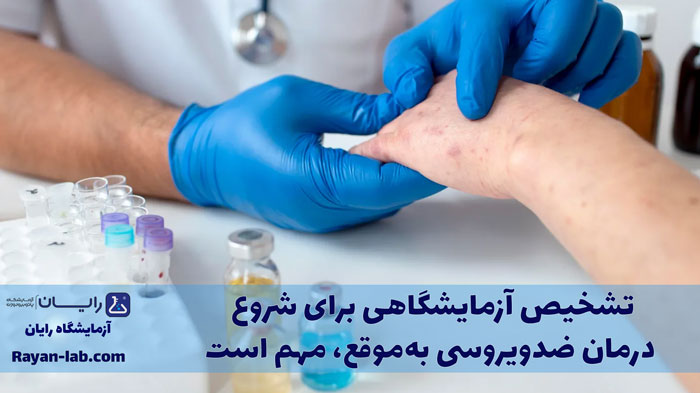 تست زونا در شیراز