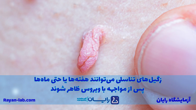 علائم زگیل تناسلی در مردان